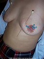 Extremely cruel needle treatments